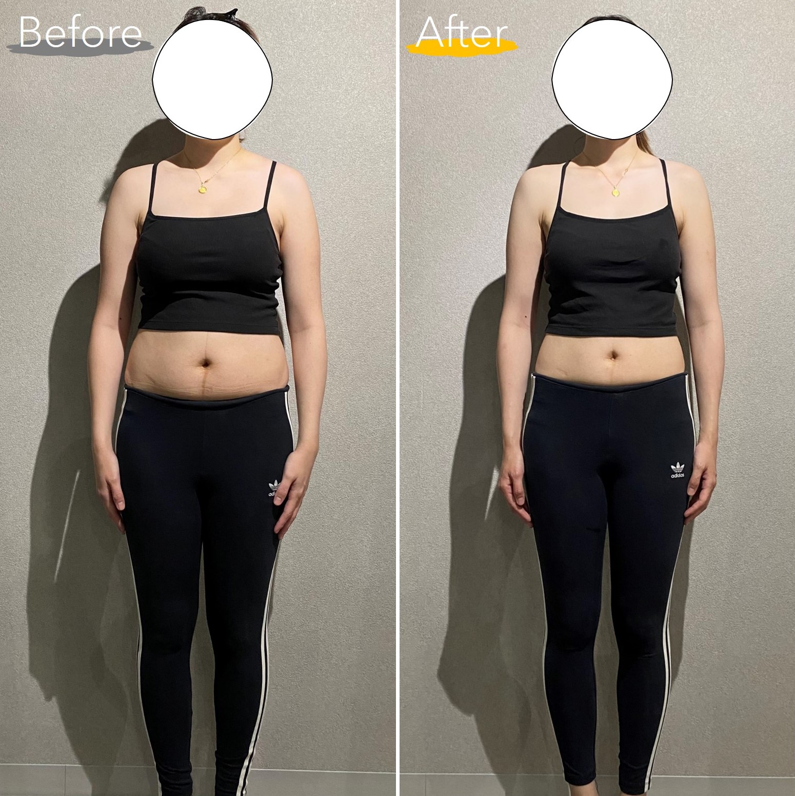 30代女性 正面 Before After