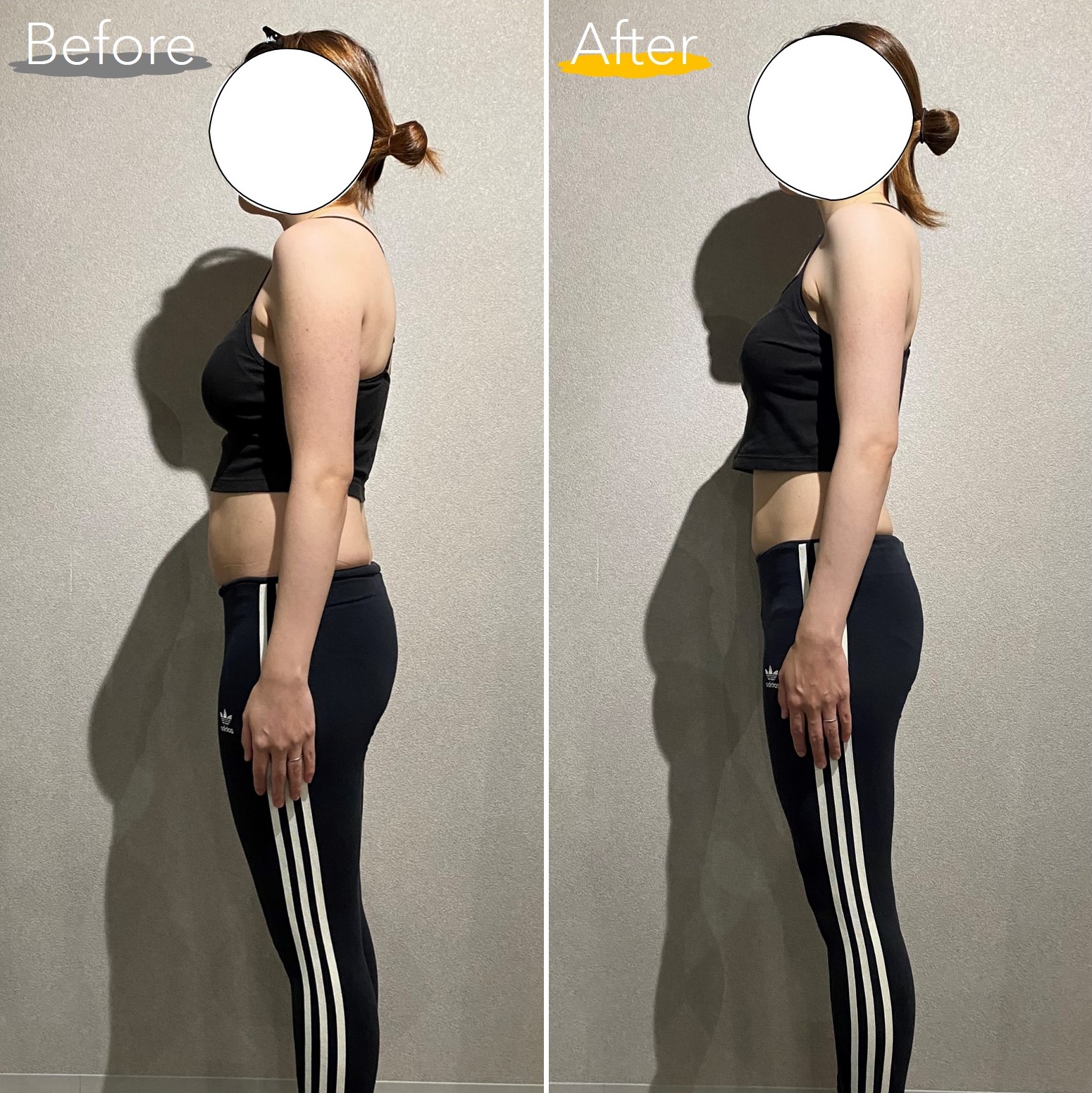 30代女性 横向き Before After