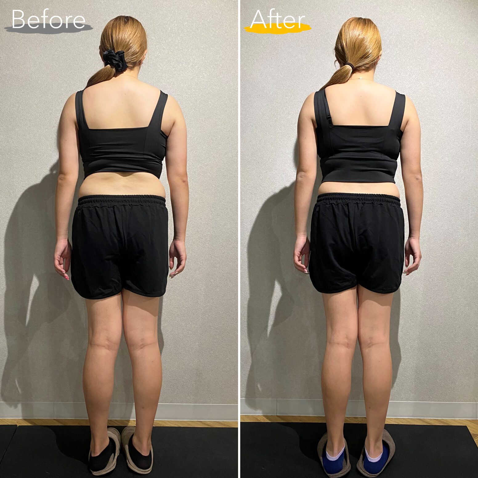 20代女性 後ろ姿 Before After