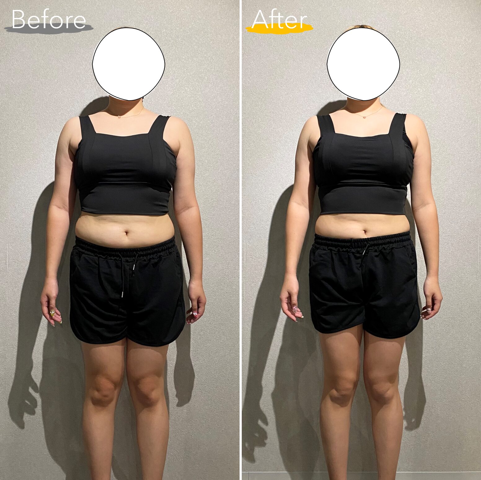 20代女性 正面 Before After
