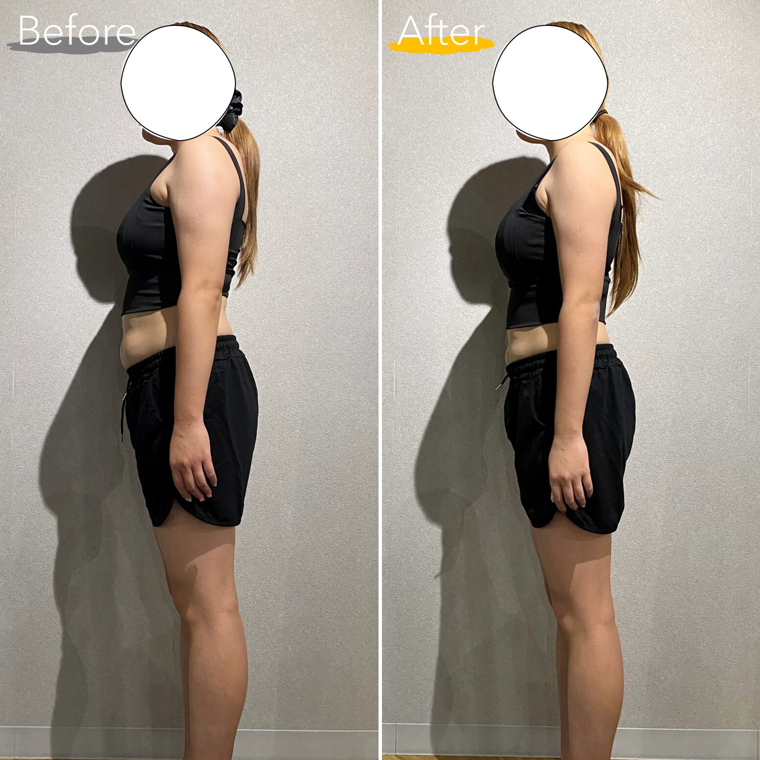 20代女性 横向き Before After